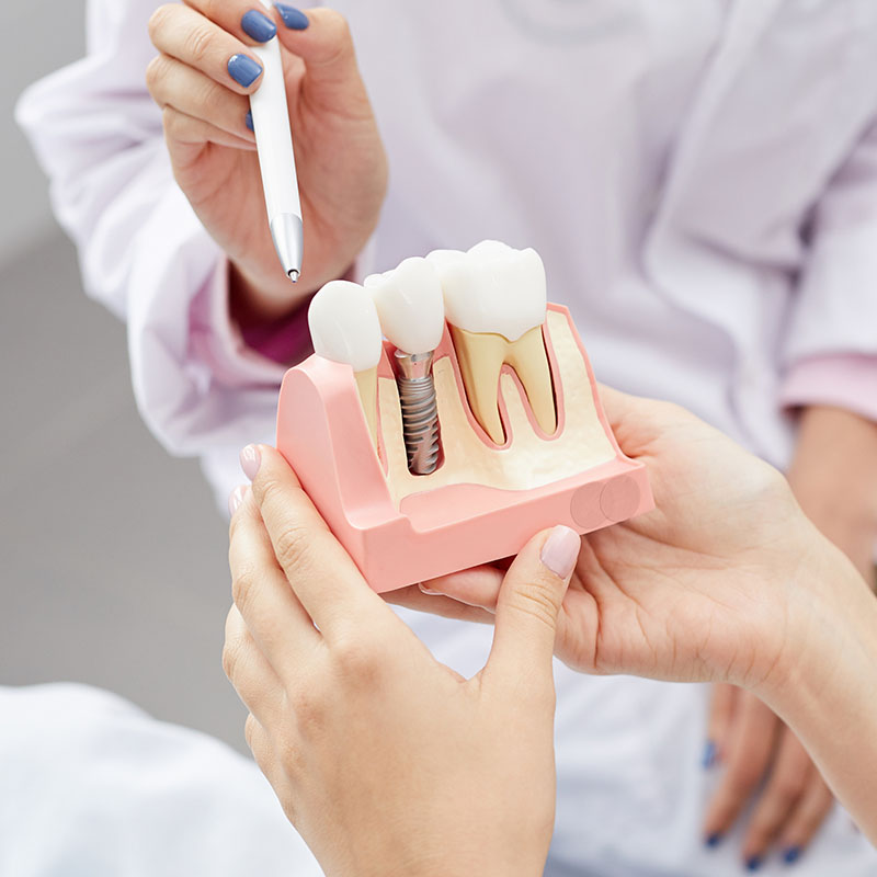 The image shows a dental professional holding a model set of teeth with various dental tools and demonstrating the use of an implant screw, while another individual observes closely.